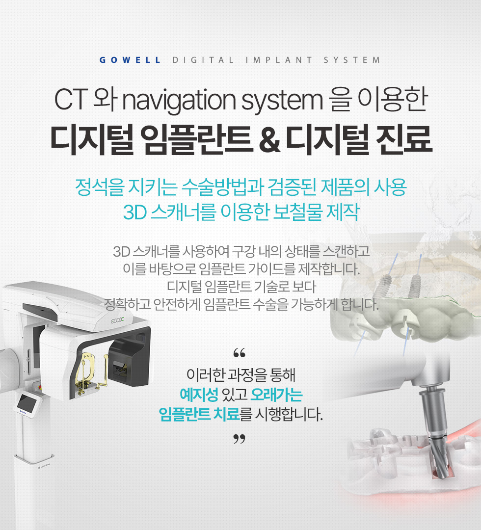 CT 와 navigation system 을 이용한 디지털 임플란트 & 디지털 진료