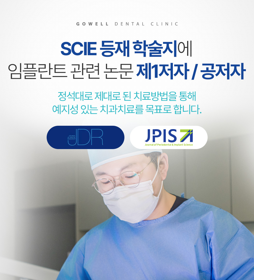 SCIE 등재 학술지에 임플란트 관련 논문 제1저자 / 공저자