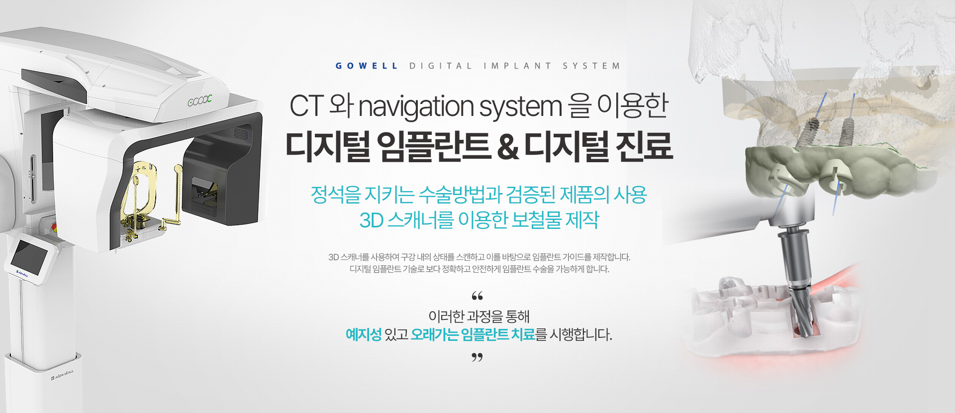 CT 와 navigation system 을 이용한 디지털 임플란트 & 디지털 진료